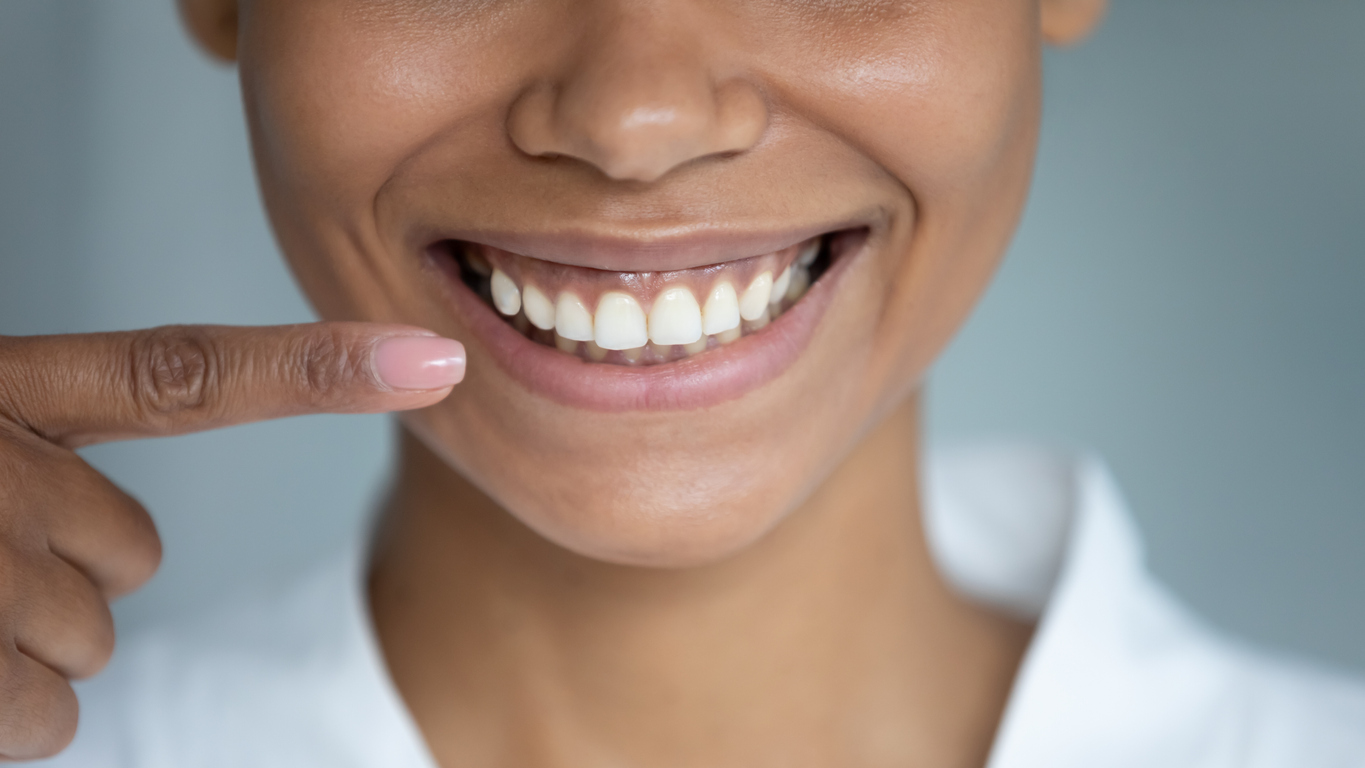 Leia mais sobre o artigo Toxina botulínica para sorriso gengival