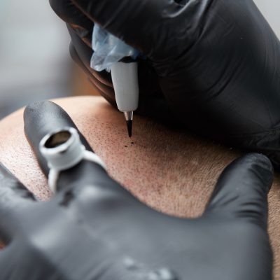 MARTY fototesseraCosmetologist making permanent makeup on man head - tricopigmentation
