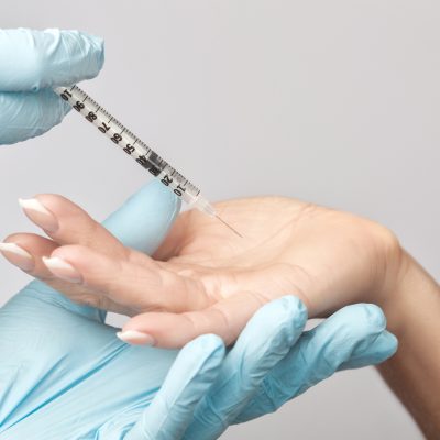 The doctor makes injections of botulinum toxin on the palms of a woman against hyperhidrosis. Women's cosmetology, skin care.